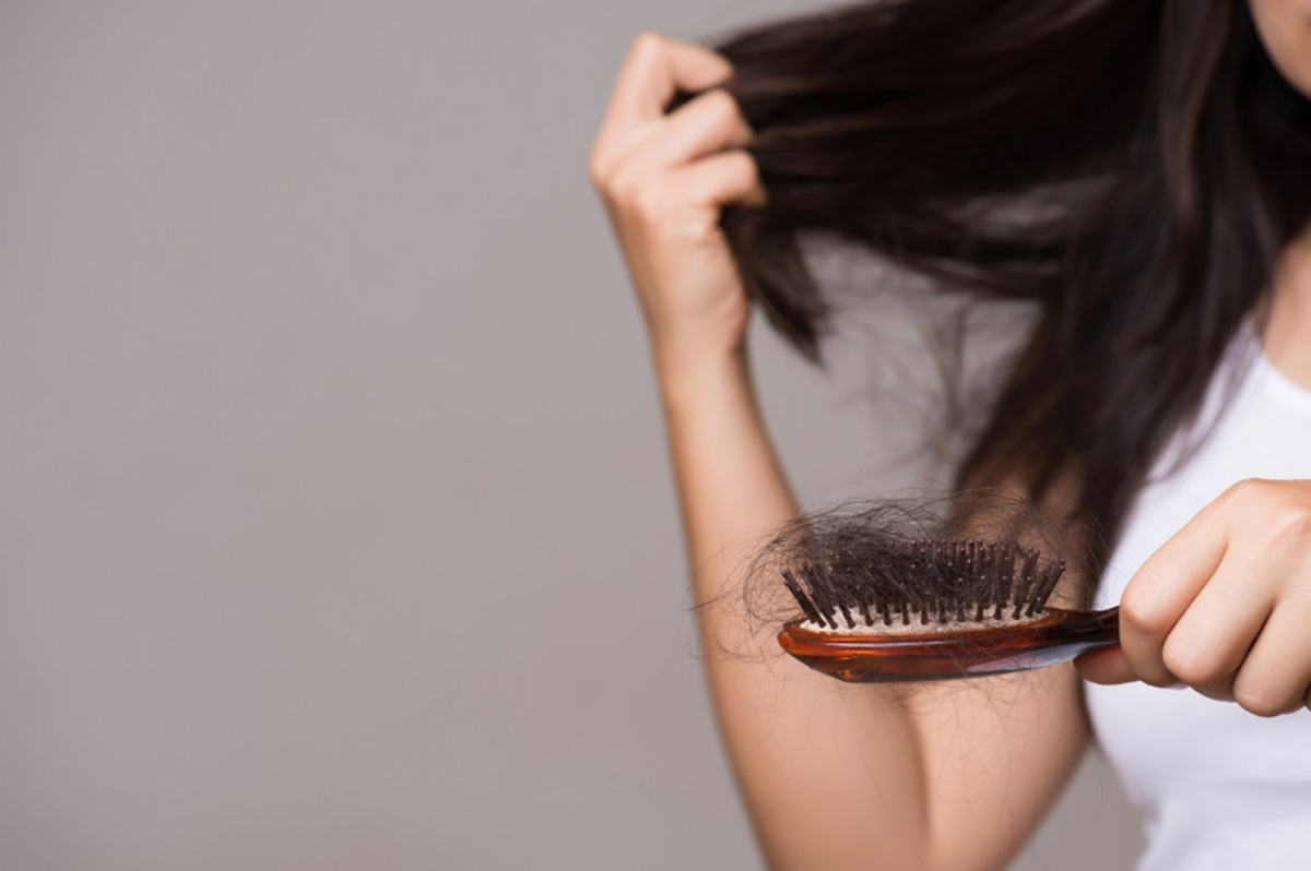 The Best Treatments for Hair Loss